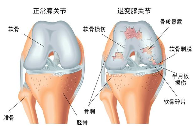 邵陽創(chuàng)傷骨科,邵陽風濕病區(qū),邵陽骨質(zhì)增生,邵陽關(guān)節(jié)病區(qū),邵陽頸椎病區(qū)