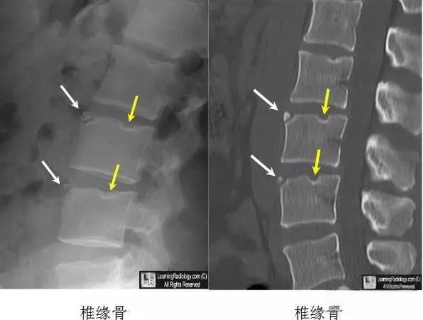 邵陽創(chuàng)傷骨科,邵陽風(fēng)濕病區(qū),邵陽骨質(zhì)增生,邵陽關(guān)節(jié)病區(qū),邵陽頸椎病區(qū)