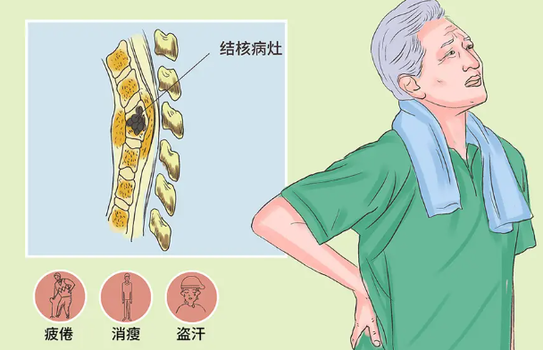 邵陽(yáng)創(chuàng)傷骨科,邵陽(yáng)風(fēng)濕病區(qū),邵陽(yáng)骨質(zhì)增生,邵陽(yáng)關(guān)節(jié)病區(qū),邵陽(yáng)頸椎病區(qū)